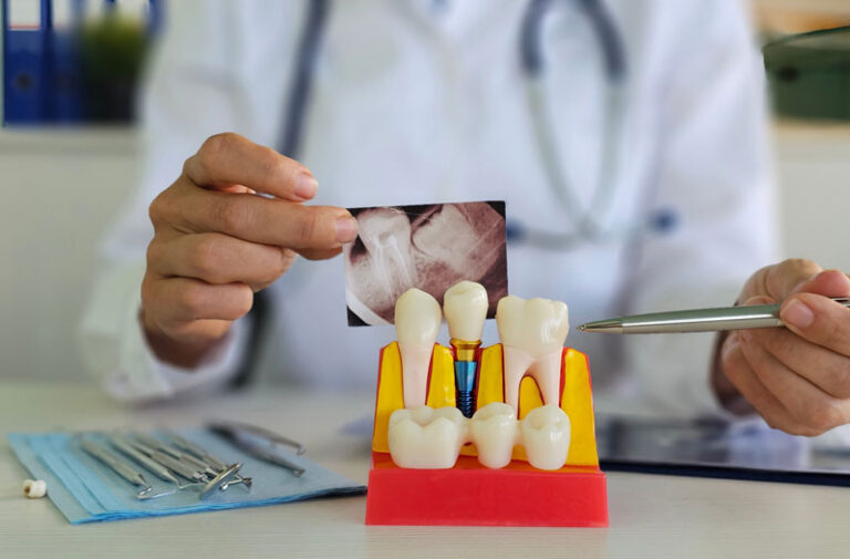 Dental professional examines tooth model and X-ray to assess patient condition and treatment options