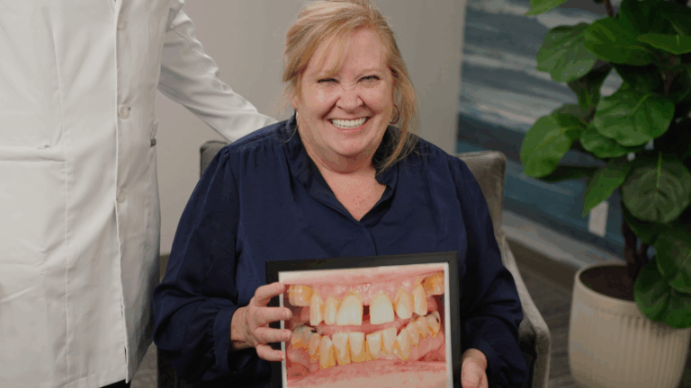 Full Mouth Dental Implants before and after photo of a female