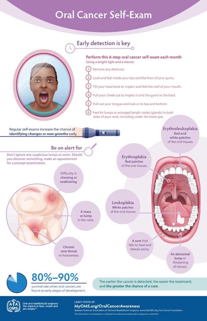 An educational infographic titled “Oral Cancer Self‑Exam” explains how to perform a monthly six‑step self‑exam using a mirror and bright light. It includes illustrations of a person checking their mouth and diagrams showing potential warning signs such as sores, lumps, and red or white patches. The infographic emphasizes early detection, lists symptoms to watch for, and notes that oral cancers found early have an 80–90% survival rate.