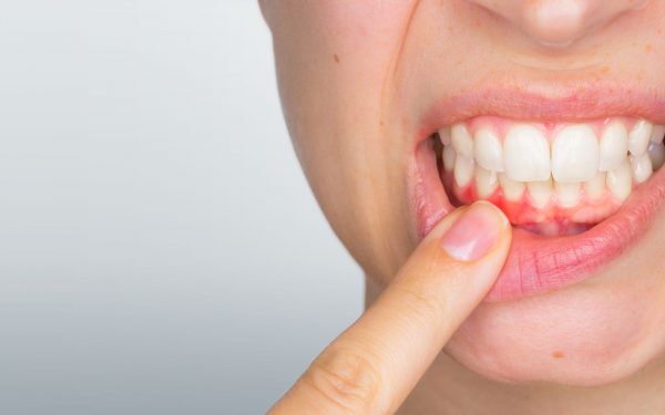 dental patient in need of periodontal treatment